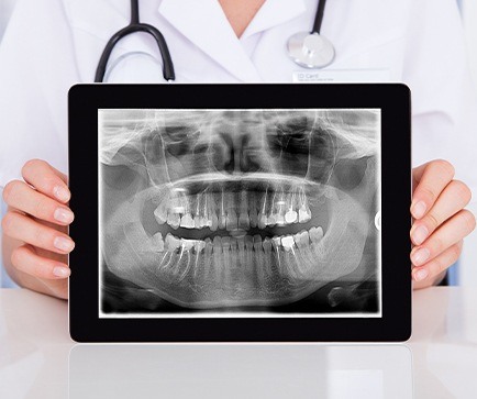 Panoramic dental x rays on tablet computer