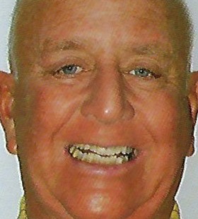 Older man with discolored and misaligned smile